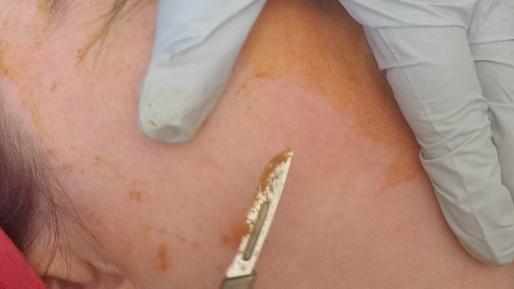 آموزش گواهینامه فیشیال و درماپلانینگ

