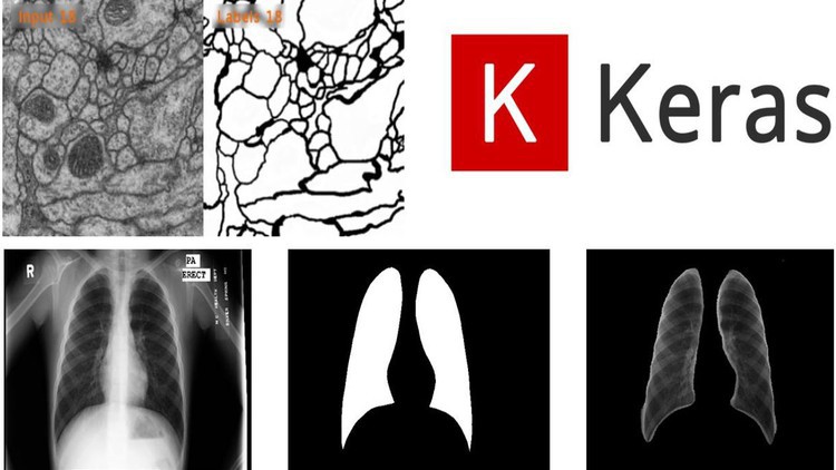 آموزش UNet: تقسیم‌بندی تصویر با UNet | 2023

