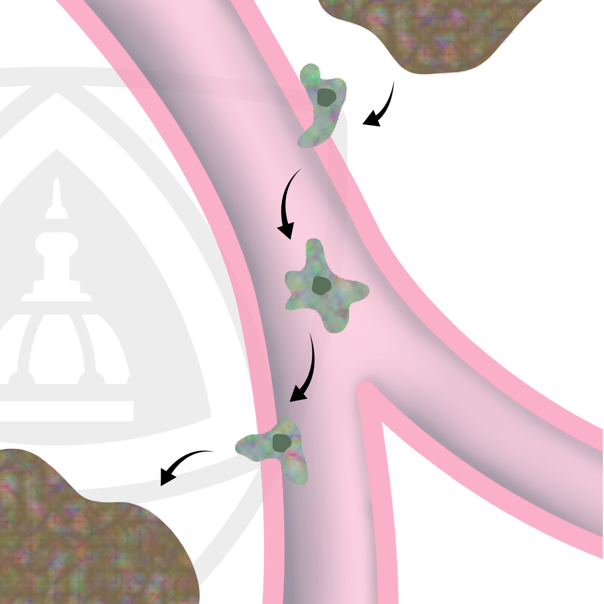 آموزش شناخت متاستاز سرطان