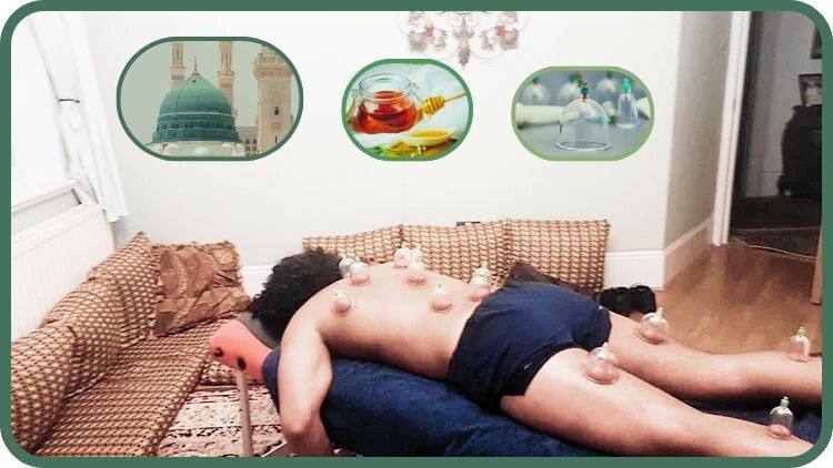 دوره آموزش حجامت تخصصی: سنت نبوی حجامت با مدرک معتبر

