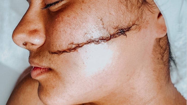 آموزش درماپلانینگ - راهنمای جامع

