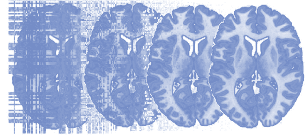 آموزش اصول تصویربرداری MRI عملکردی (fMRI) ۱
