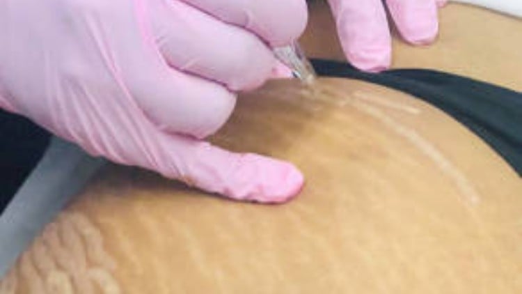 آموزش دوره استرچ مارک اسکارف کاموفلاژ
