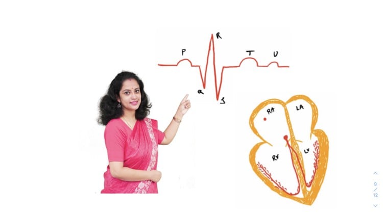 آموزش نوار قلب (ECG/EKG) به همراه تفسیر، تست‌های چند گزینه‌ای (MCQ) و نکات مهم

