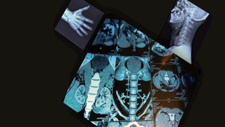 آموزش تفسیر آسان تصاویر پزشکی (اشعه ایکس، سی تی اسکن، ام آر آی)
