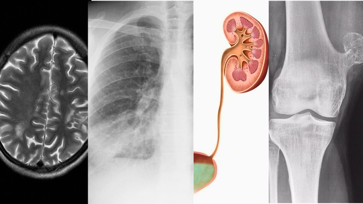 آموزش رادیولوژی بالینی به زبان ساده

