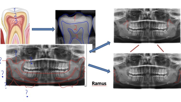 آموزش دوره رادیولوژی اشعه ایکس دندانپزشکی

