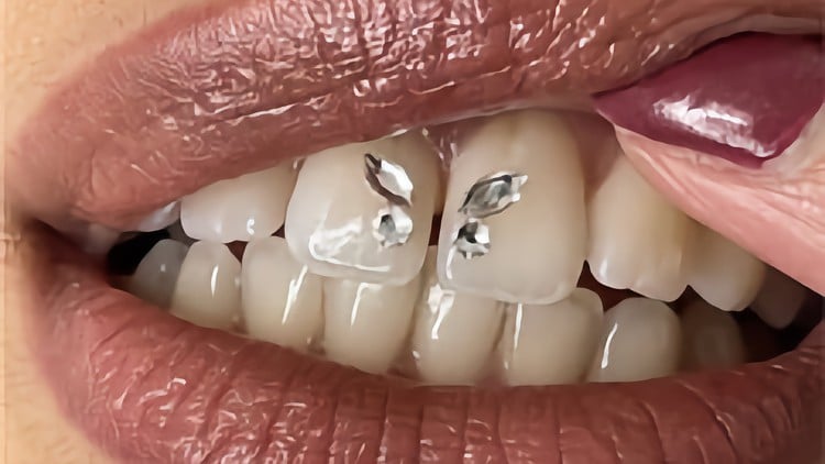 دوره آموزشی تکنسین نگین دندان با مدرک معتبر
