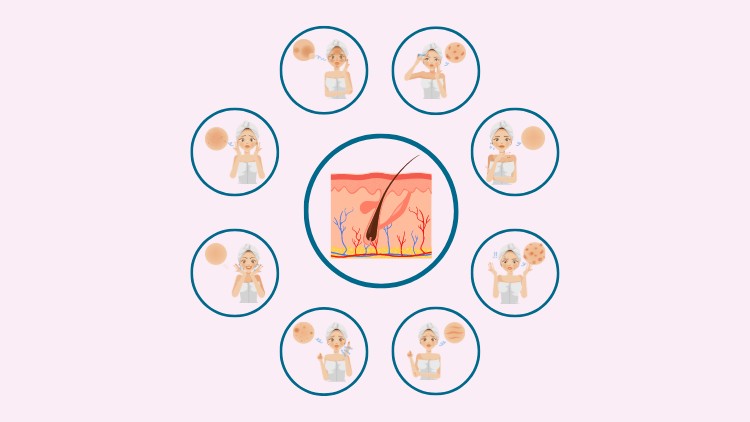 آموزش انواع پوست رمزگشایی شده
