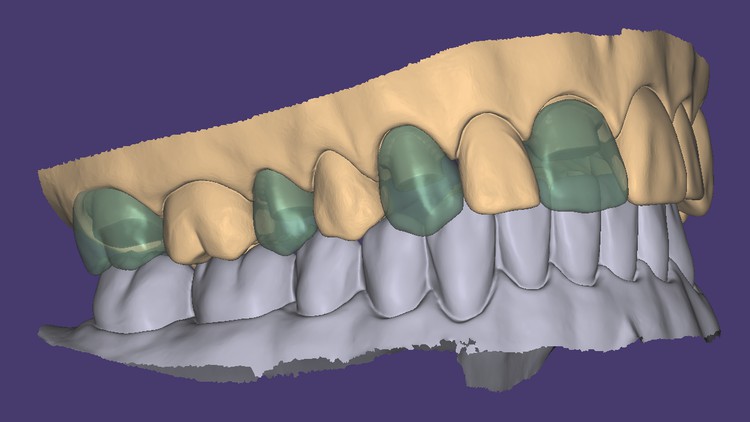 آموزش دندانسازی دیجیتال، کد-کم و تصمیم‌گیری
