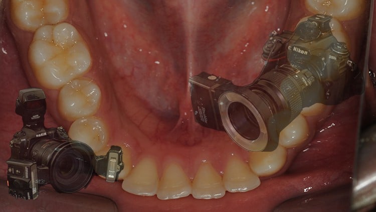 آموزش عکاسی بالینی در دندانپزشکی
