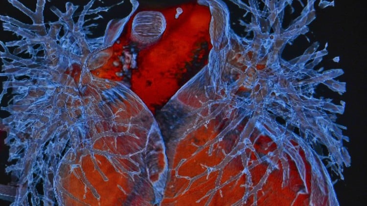 آموزش دیپلم رادیولوژی بالینی و تصویربرداری پزشکی

