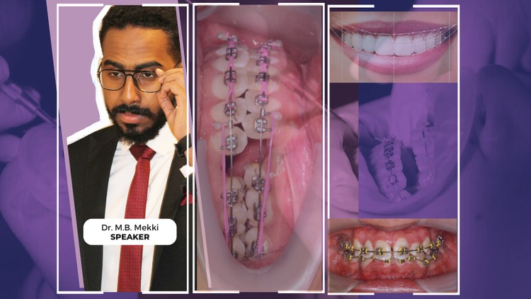 آموزش ارتودنسی پیشرفته: اصول برنامه‌ریزی درمان
