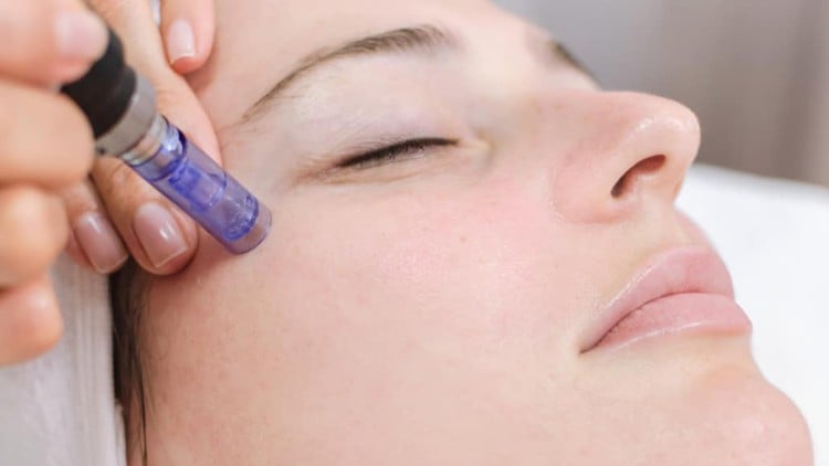 آموزش گواهینامه حرفه ای میکرونیدلینگ
