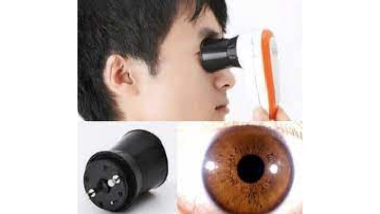 آموزش آیریدولوژی - تشخیص وضعیت سلامتی با استفاده از زیرگونه‌ها (قسمت ۲)
