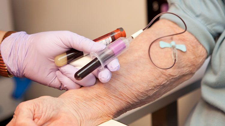 آموزش مقدمه‌ای بر فلبوتومی (مبتنی بر دانش)
