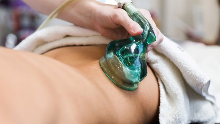 آموزش کلمبیایی وکیوم تراپی
