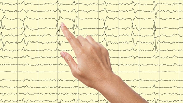 آموزش اصول الکتروانسفالوگرافی (EEG) در بزرگسالان
