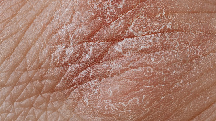 آموزش درماتولوژی - تجزیه و تحلیل سیستماتیک برای تسلط بر پوست و مو
